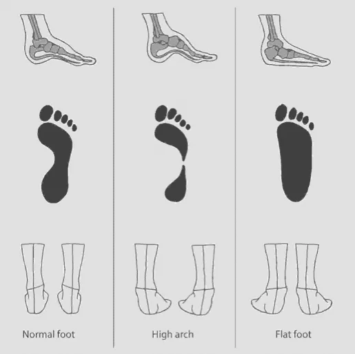 Jenis Kaki Jenis Kaki