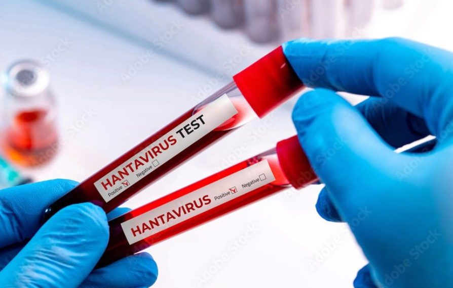 Kasus Hantavirus Jadi Perhatian, Kemenkes Minta Warga Tetap Tenang
