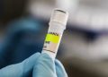 Waspada Hantavirus dari Tikus Liar, BRIN Ingatkan Pentingnya PHBS dan Disinfektan