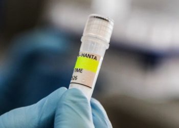Waspada Hantavirus dari Tikus Liar, BRIN Ingatkan Pentingnya PHBS dan Disinfektan