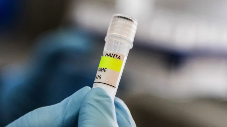 Waspada Hantavirus dari Tikus Liar, BRIN Ingatkan Pentingnya PHBS dan Disinfektan