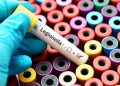New York Laporkan Tiga Kematian dalam Wabah Legionnaires di Upper East Side