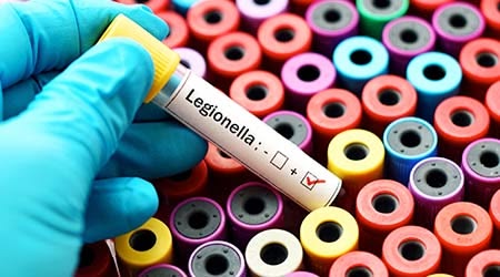 New York Laporkan Tiga Kematian dalam Wabah Legionnaires di Upper East Side