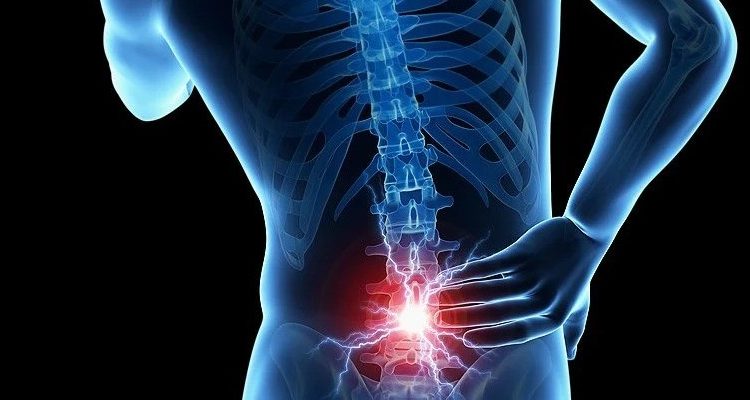 Nyeri Punggung Belum Tentu Sakit Ginjal, Kenali 3 Perbedaan Utamanya