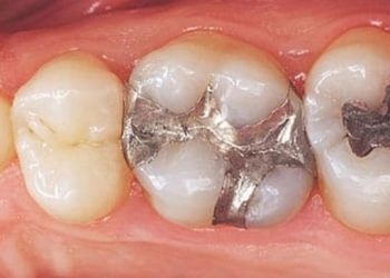 Pria di China Datangi Klinik untuk Keluhan Satu Gigi, Akhirnya Berujung Petaka