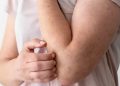 Alergi Bisa Sembuh Total atau Tidak? Begini Penjelasan Medisnya