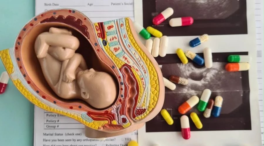 Korea Selatan Siapkan Izin Pil Aborsi