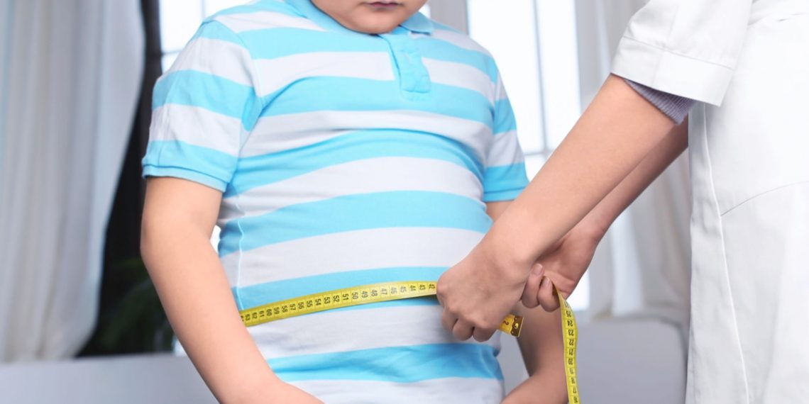 Mengapa Obesitas pada Anak Perlu Diwaspadai Sejak Dini?