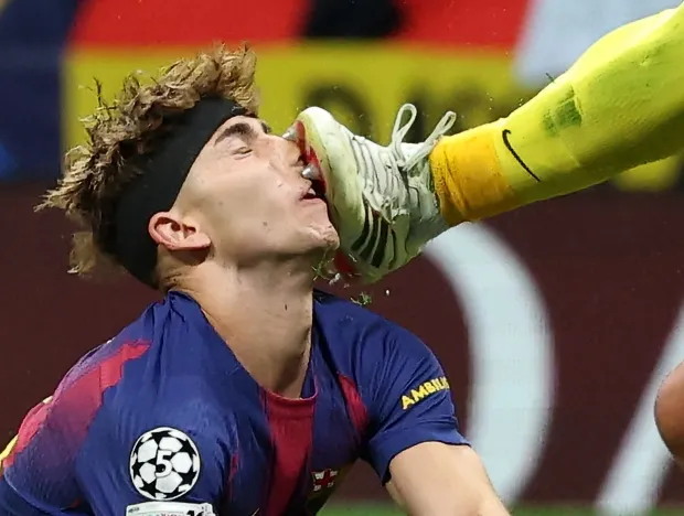Fermin Lopez Suffers Facial Injury After Collision With Juan Musso in Atletico vs Barcelona