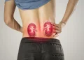 From Soda to Sweet Coffee: Drinks That Could Increase Kidney Failure Risk