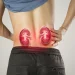 From Soda to Sweet Coffee: Drinks That Could Increase Kidney Failure Risk