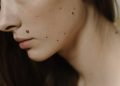 Astrology Beliefs Highlight 6 Lucky Mole Spots Associated With Success