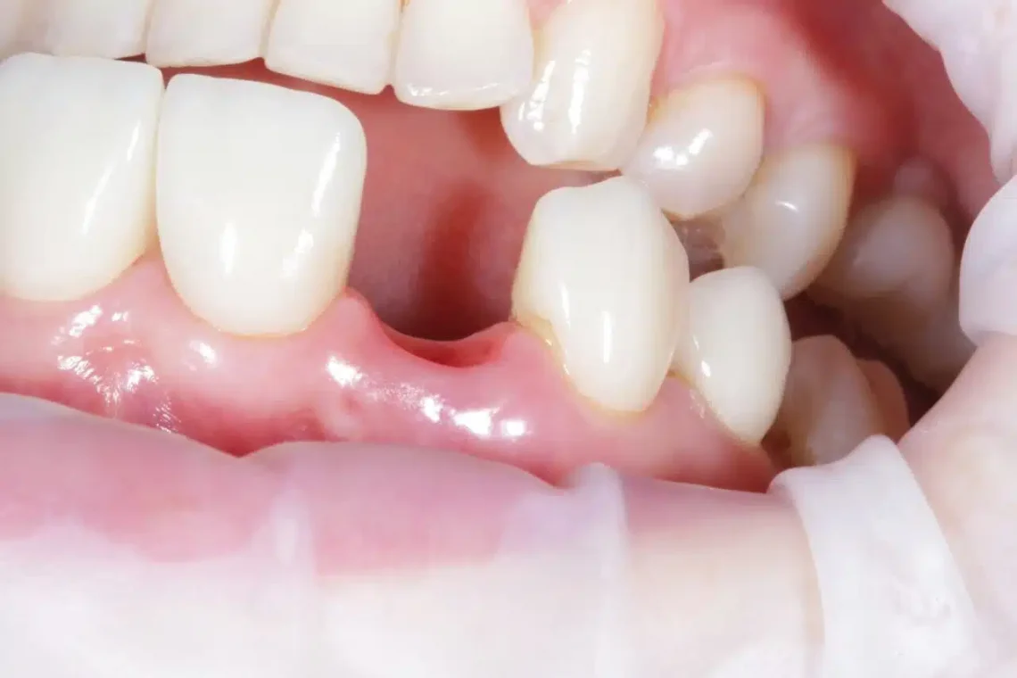 Japanese Scientists Test Revolutionary Medicine That Could Regrow Teeth
