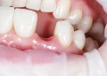 Japanese Scientists Test Revolutionary Medicine That Could Regrow Teeth