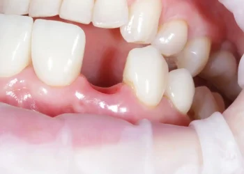 Japanese Scientists Test Revolutionary Medicine That Could Regrow Teeth