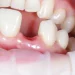 Japanese Scientists Test Revolutionary Medicine That Could Regrow Teeth