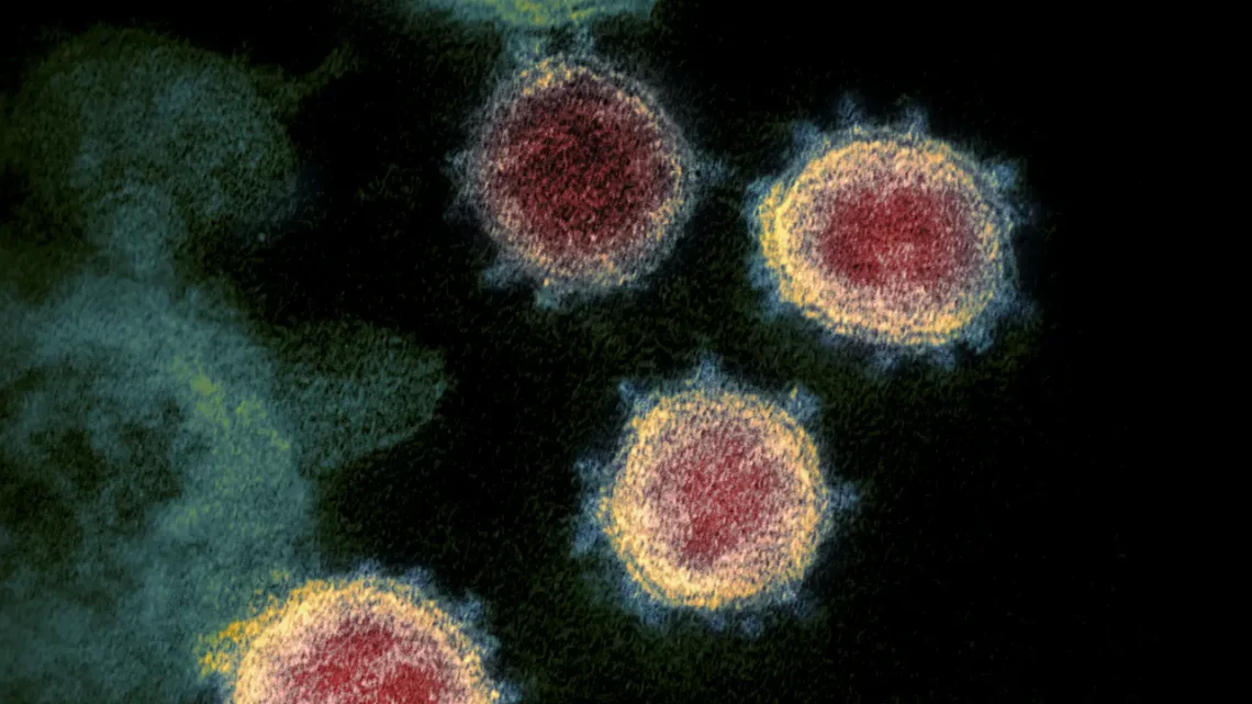 Influenza A