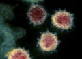 Influenza A