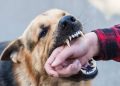 Bitten by a Dog? Do These 5 Things Immediately
