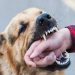 Bitten by a Dog? Do These 5 Things Immediately