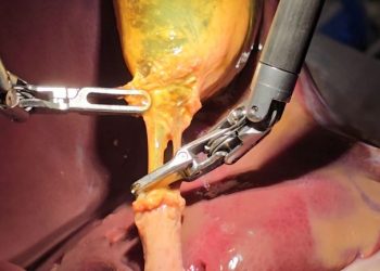 Who Controls a Surgical Robot During an Operation?