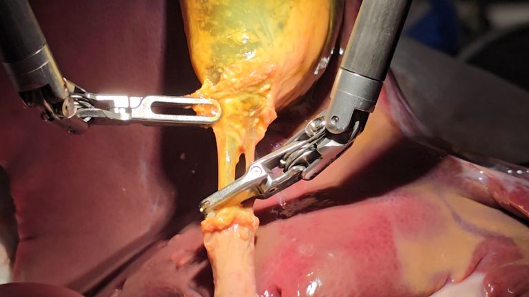 Who Controls a Surgical Robot During an Operation?