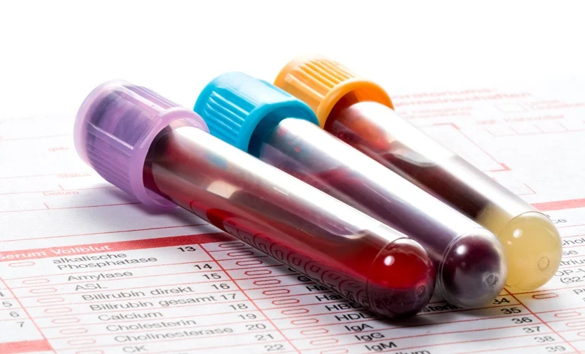 This Blood Type May Have a Higher Risk of Type 2 Diabetes, Study Finds