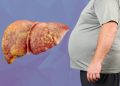Sugary Drinks May Raise Fatty Liver Risk, Doctors Warn