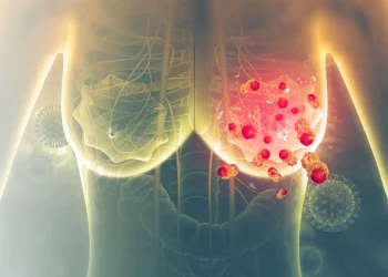 Breast Cancer Can Develop Without Family History, Doctor Warns