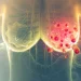 Breast Cancer Can Develop Without Family History, Doctor Warns