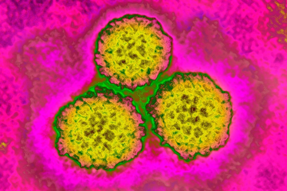 12% of Global Cancer Cases Linked to Infections, Study Finds
