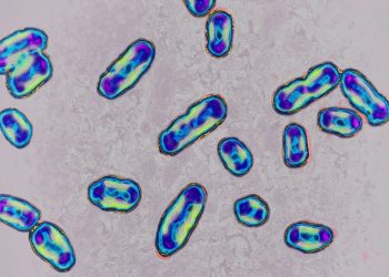 What Is the Plague? Symptoms and Risks You Need to Know