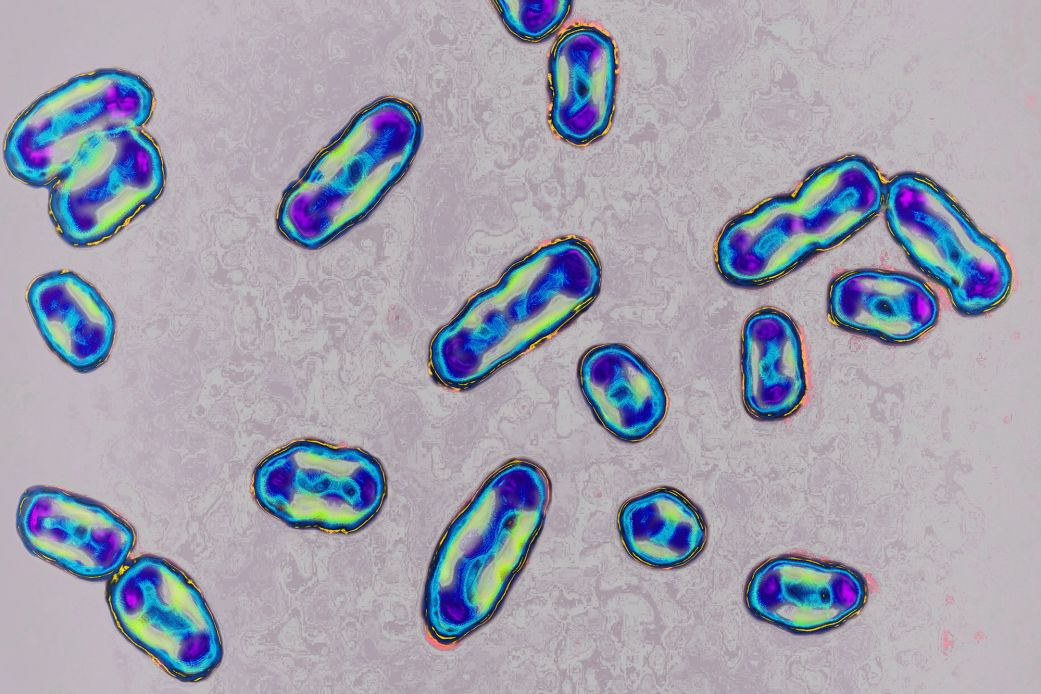What Is the Plague? Symptoms and Risks You Need to Know