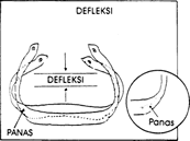 tips_01