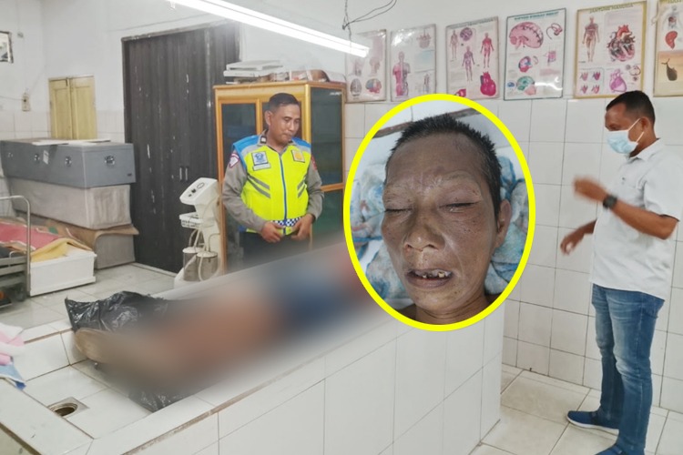 Korban tabrak lari tanpa identitas. (foto: ist)