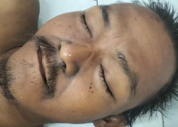Mayat tanpa identitas atau Mr X masih dititip diruangan jenajah RSUD dr Djasamen Saragih Kota Pematangsiantar