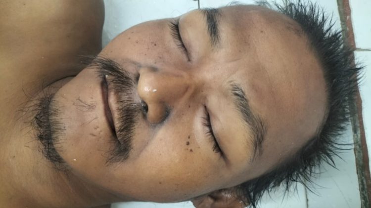 Mayat tanpa identitas atau Mr X masih dititip diruangan jenajah RSUD dr Djasamen Saragih Kota Pematangsiantar