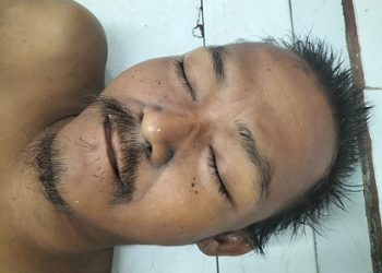 Mayat laki laki tanpa idenitas (Mr X) dititipkan diruangan jenajah RSUD dr Djasamen Saragih Kota Pematangsiantar