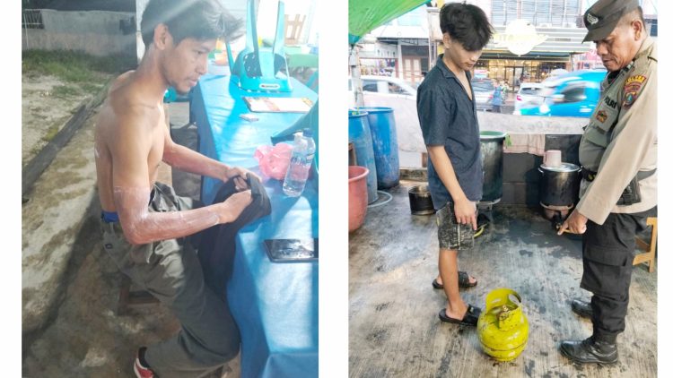 personil piket Polsek Siantar Selatan saat olah TKP dan Fauzi Azhari luka bakar ditangan kirinya