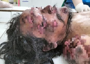 Jenajah pria rambut gimbal dititip diruangan jenajah RSUD dr Djasamen Saragih Kota Pematangsiantar