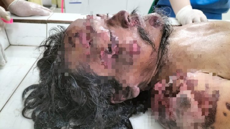 Jenajah pria rambut gimbal dititip diruangan jenajah RSUD dr Djasamen Saragih Kota Pematangsiantar
