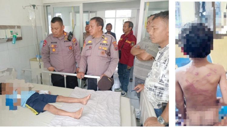 Kapolsek Siantar Marihat AKP David Eka Putra SH bersama para Kanit saat cek korban opname di RSUD dr Djasamen Saragih