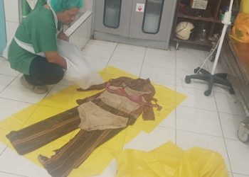 Pakaian yang dipakai Mayat Mrs X saat ditemukan