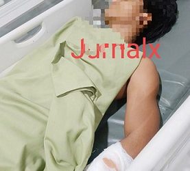 H korban begal saat menjalani perawatan medis di RSU Karya Husada