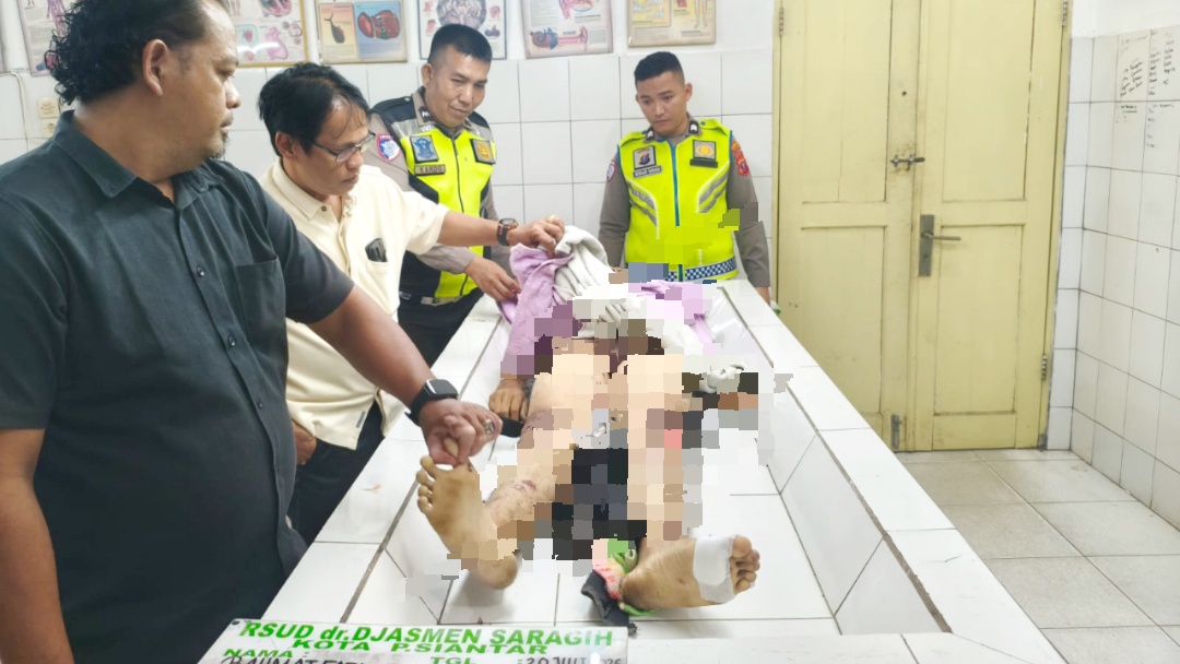 Jenajah korban Rahmad Fadli Siregar saat divisum diruangan jenajah RSUD dr Djasamen Saragih Kota Pematangsiantar