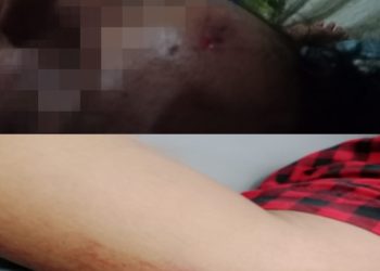 Seorang pengendara bernama Boru Panggabean terjatuh ketika melintas di Jalan Lintas Kecamatan Ujung Padang, tepatnya di Simpang Pocong, pada Selasa (16/09/2025). Insiden itu terjadi akibat korban berusaha menghindari sekelompok remaja yang sedang melakukan balap liar.