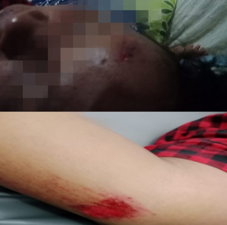 Seorang pengendara bernama Boru Panggabean terjatuh ketika melintas di Jalan Lintas Kecamatan Ujung Padang, tepatnya di Simpang Pocong, pada Selasa (16/09/2025). Insiden itu terjadi akibat korban berusaha menghindari sekelompok remaja yang sedang melakukan balap liar.