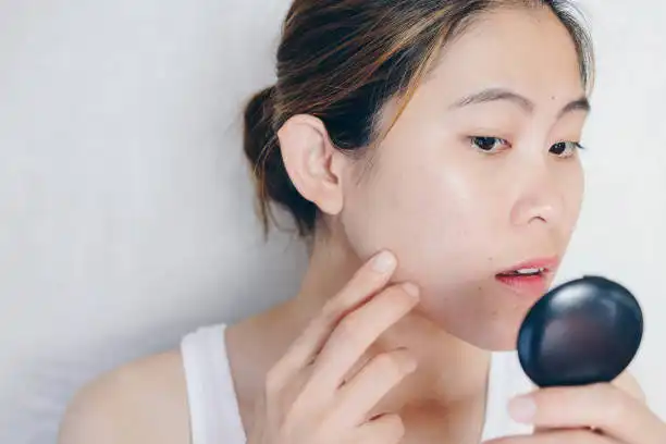 Kulit Berminyak? Ini Rahasia Cuci Muka yang Benar