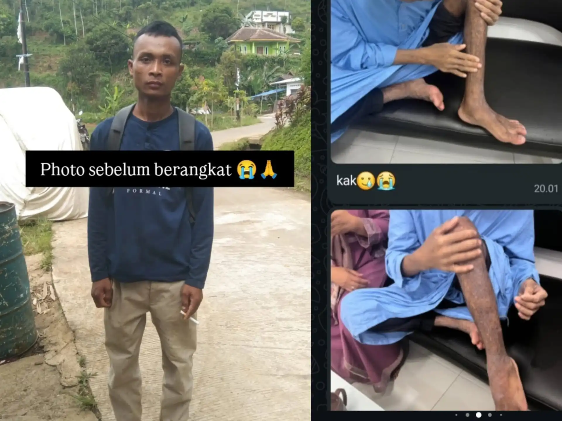 Dititip ke Yayasan Rehabilitas di Pangandaran, Pasien ODGJ Diduga Dianiaya hingga Meninggal, Keluarga Temukan Luka Lebam di Sekujur Tubuh