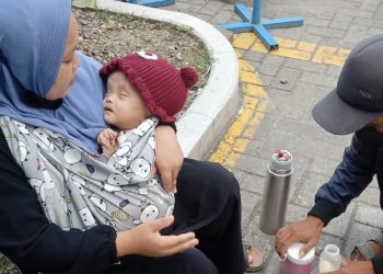 Polisi Peduli Warga Disambut Gerak Cepat Wabup Rianto dan BRI Kisaran Tangani Balita Hidrosefalus